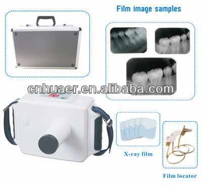 中国alibabaの熱い販売のポータブル歯科用x線装置/高品質歯科用x線装置/x線装置仕入れ・メーカー・工場