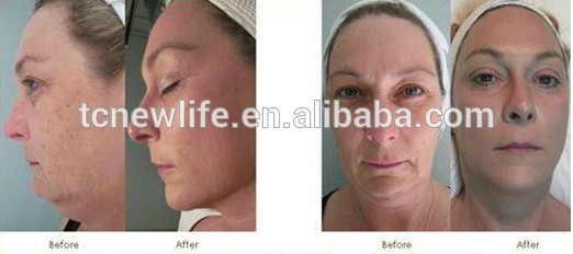 ダイヤモンドのmicrodermabrasionと酸素2014年- nl-spa900マシンce問屋・仕入れ・卸・卸売り