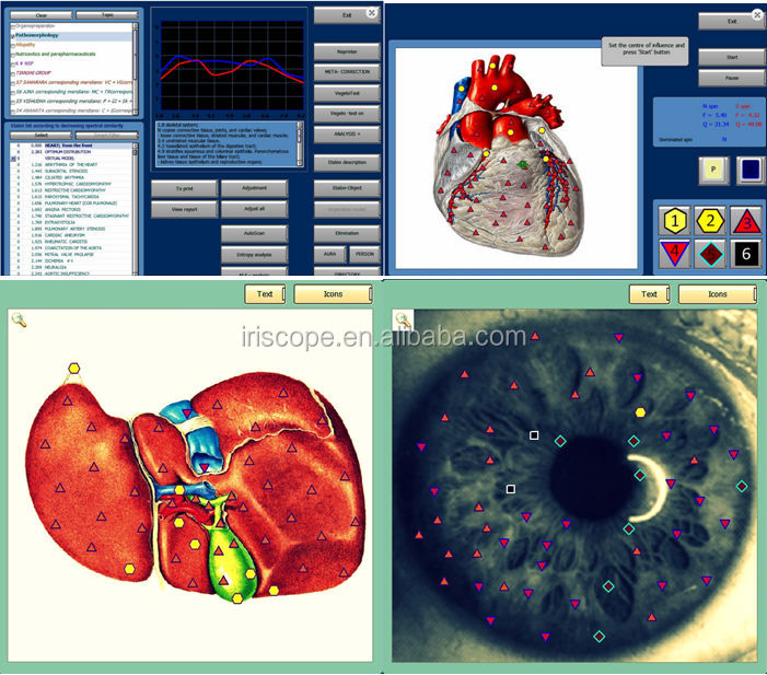 2015 latest version best professional 8d nls health analyzer