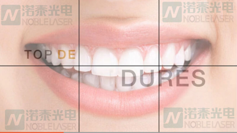 歯科ダイオードレーザーレーザー美容機歯を白くするためのポータブルデバイスレーザ加工機 問屋・仕入れ・卸・卸売り