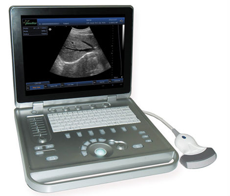 AG-BU009 carrying hospital Handheld color cardiac ultrasound machine