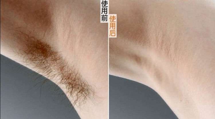 新しい毛除去クリームを3のオプションでcuretg1010oemのための問屋・仕入れ・卸・卸売り
