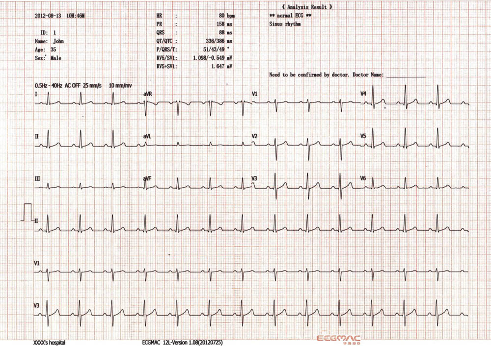 デジタルem-120312- チャネルecg/ekg、 12インチカラーlcdとサポートpcl言語外部プリンタecgマシン仕入れ・メーカー・工場