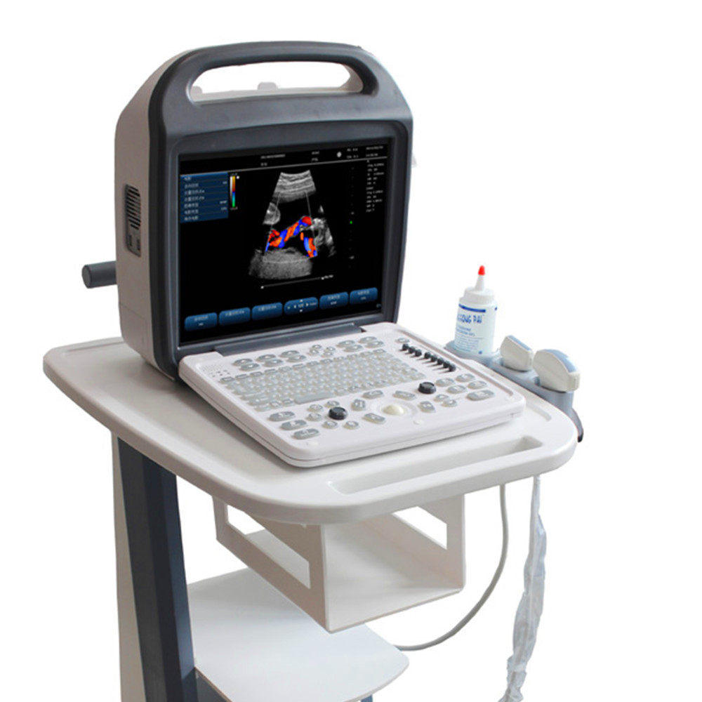 妊娠のためのラップトップの超音波装置仕入れ・メーカー・工場