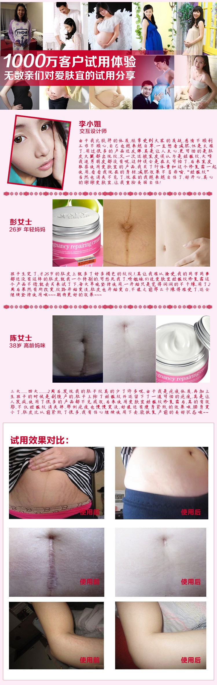 オリーブオイルママ出産修理にきび瘢痕光除去治療ストレッチマーク除去クリーム 問屋・仕入れ・卸・卸売り