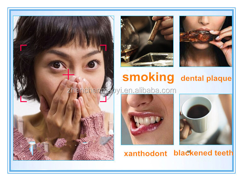 プロの漂白剤キット、 歯のキットを白くする、 白の笑顔明るい歯ホワイトニングキット 問屋・仕入れ・卸・卸売り