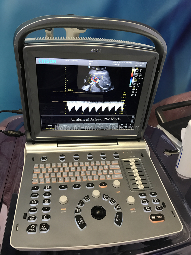 China Chison Eco5 Portable Vascular Doppler Ultrasound Machine Price