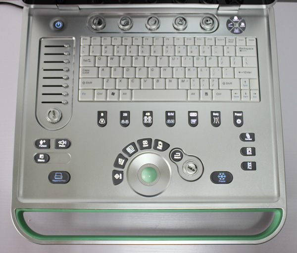 SS-9 PC ba<em></em>sed Laptop Ultrasound B scanner(ultrasound, ultrasoni, scanner)仕入れ・メーカー・工場
