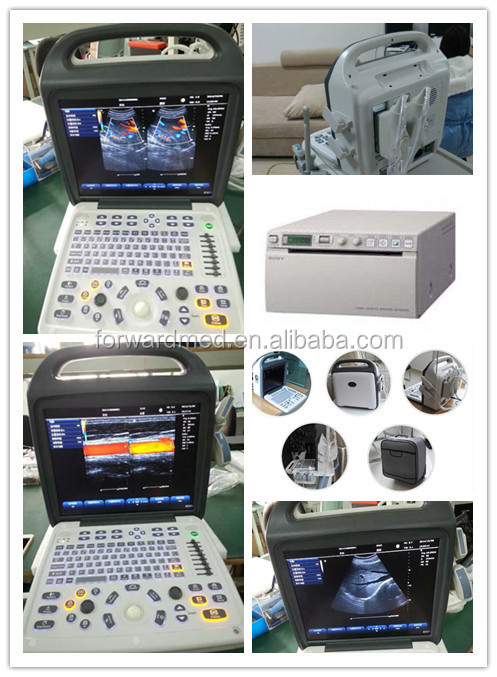 カラードップラー超音波診断機ラップトップの超音波装置仕入れ・メーカー・工場