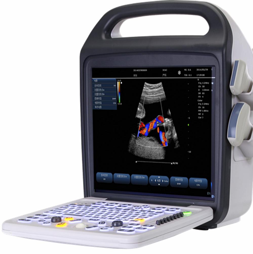 妊娠のためのラップトップの超音波装置仕入れ・メーカー・工場