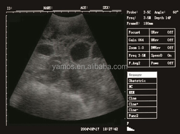 ミニ超音波デバイスのための中国のサプライヤーの妊娠検査仕入れ・メーカー・工場