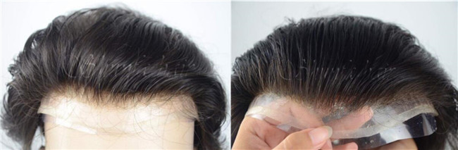 graduated hairline.jpg