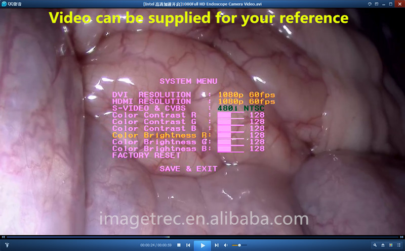 Agree, Endoscopy in pussy video Opinion you Endoscopy in pussy video