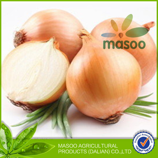 2014 Seasonable Fresh Onion In Different Pack