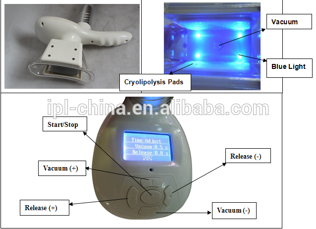 cool slimming laser slimming machine machine 3 in 1 vacuum