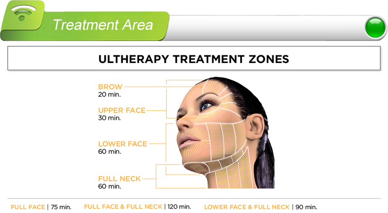 プロの2015ultherapyマシンの販売、 集束超音波hifu高強度、 33侵入深さのヒント必要な販売代理店問屋・仕入れ・卸・卸売り