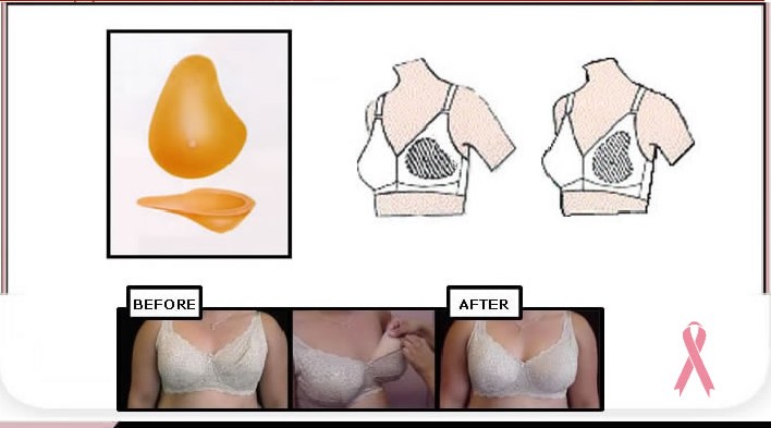 自然なシリコーンレディス100％経済人工乳房切除術のための偽の乳房問屋・仕入れ・卸・卸売り