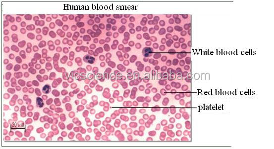 microscopio preparato diapositive prezzo competitivo accessori microscopio  ematologia preparato diapositive sangue striscio di sangue