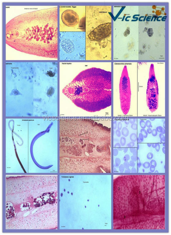 高品質と最高の価格のガラスparasitology生物顕微鏡用スライドセット問屋・仕入れ・卸・卸売り