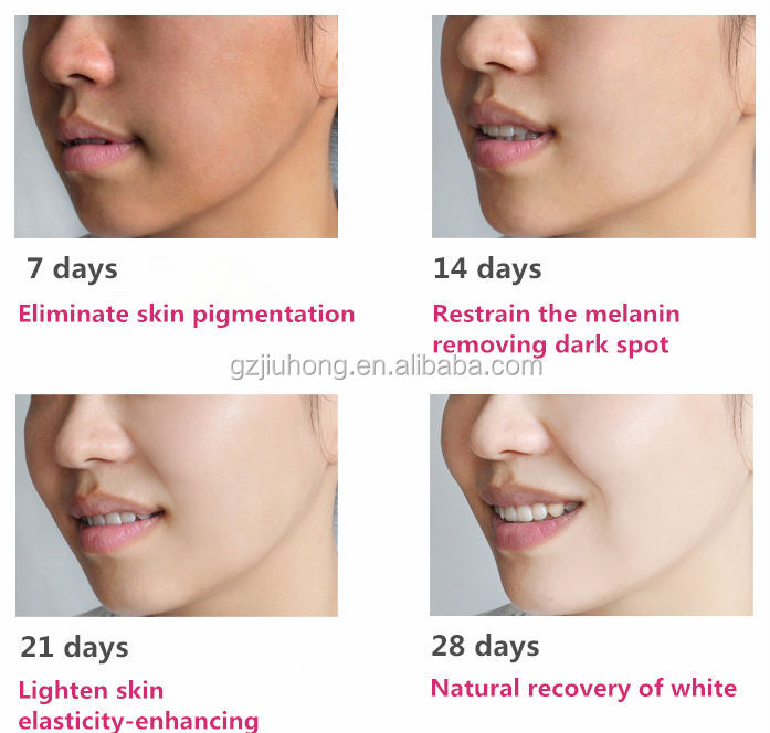 Spot Removal Black Skin Best Whitening Bleach Cream - Buy Whitening 