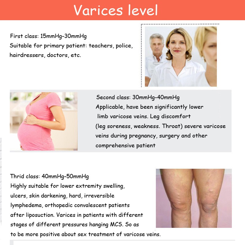 varices level.jpg