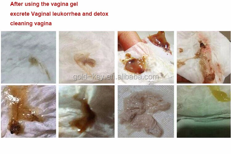 Vaginal,vaginalis vagina shrinking gel sexy young virginity vagina tightening gel