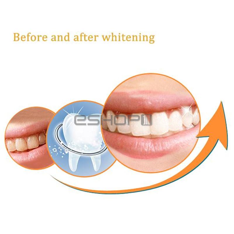 Teeth Whitening White Dental Bleaching Oral Gel Wholesale Teeth Whitening White Dental