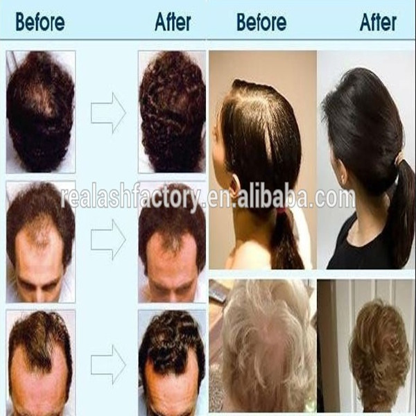 Real Plus Hair Growth Spray Natural Herbal Extract Best Anti Hair
