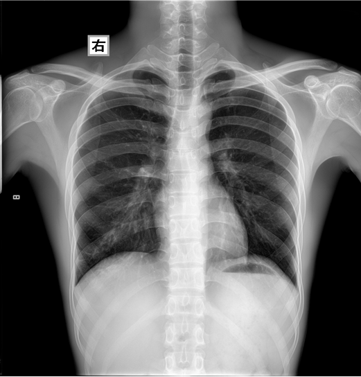 Sex Ct Scan 61