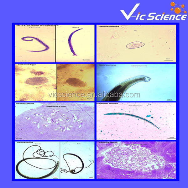 医療parasitology50個準備されたスライドセット問屋・仕入れ・卸・卸売り