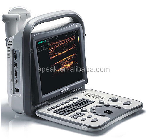 Sonoscapea6黒と白のポータブル超音波機器fda、 腹部にce認定品、、 msk、/obgyn、 血管仕入れ・メーカー・工場