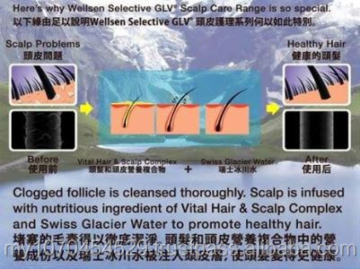 ベストセラー頭皮ケア製品とスイスの氷河水 問屋・仕入れ・卸・卸売り