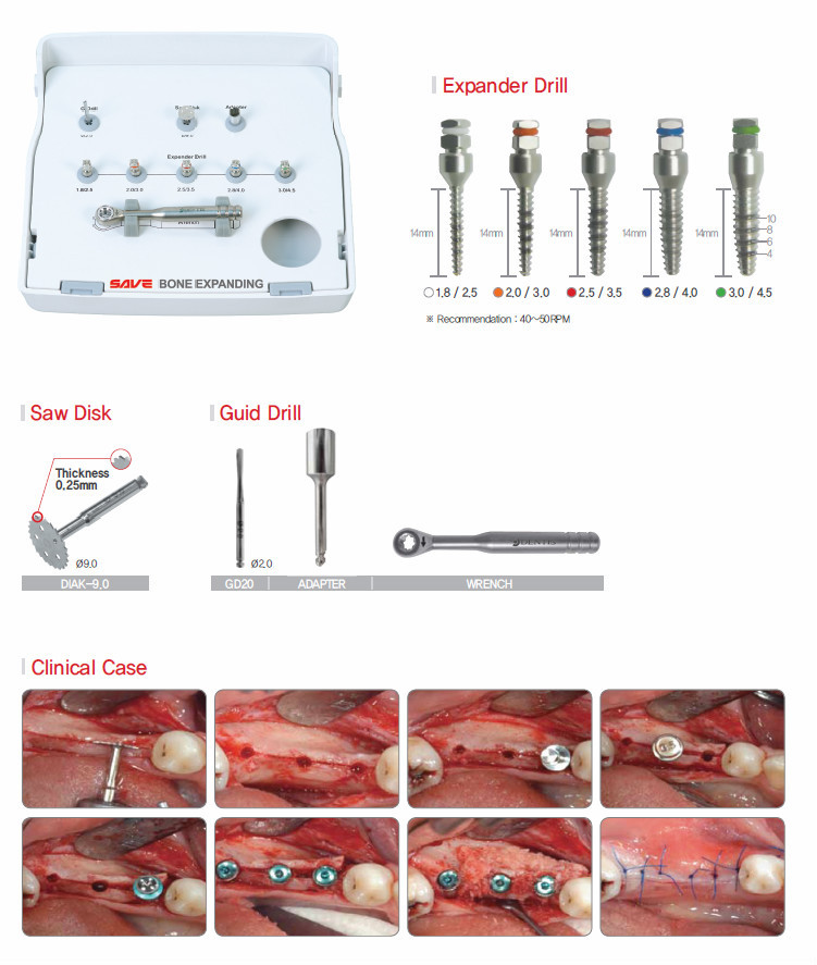 骨インプラントを節約するdentis拡大- 副鼻腔・楽器キット仕入れ・メーカー・工場